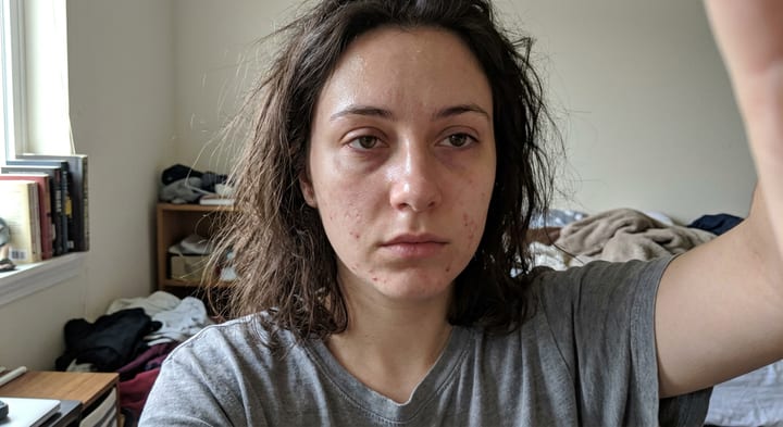 Selfie Cleanup — before